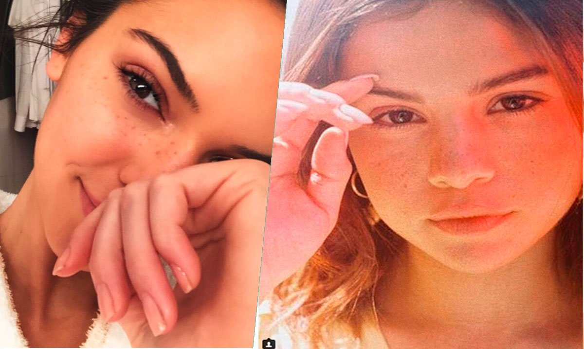 La Nueva Tendencia de Belleza: Pecas Falsas